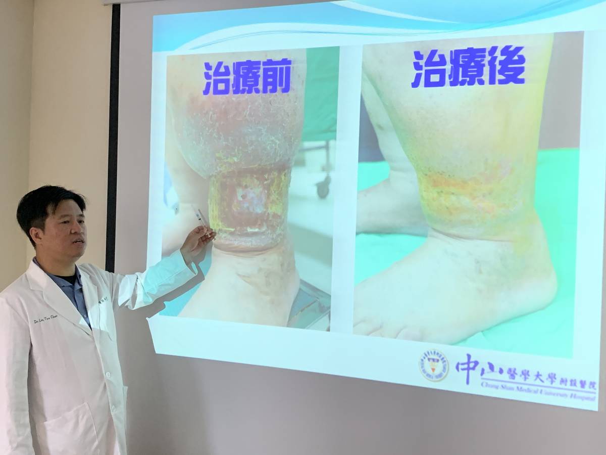 中山附醫皮膚科林子鈞醫師說明治療前後情形 