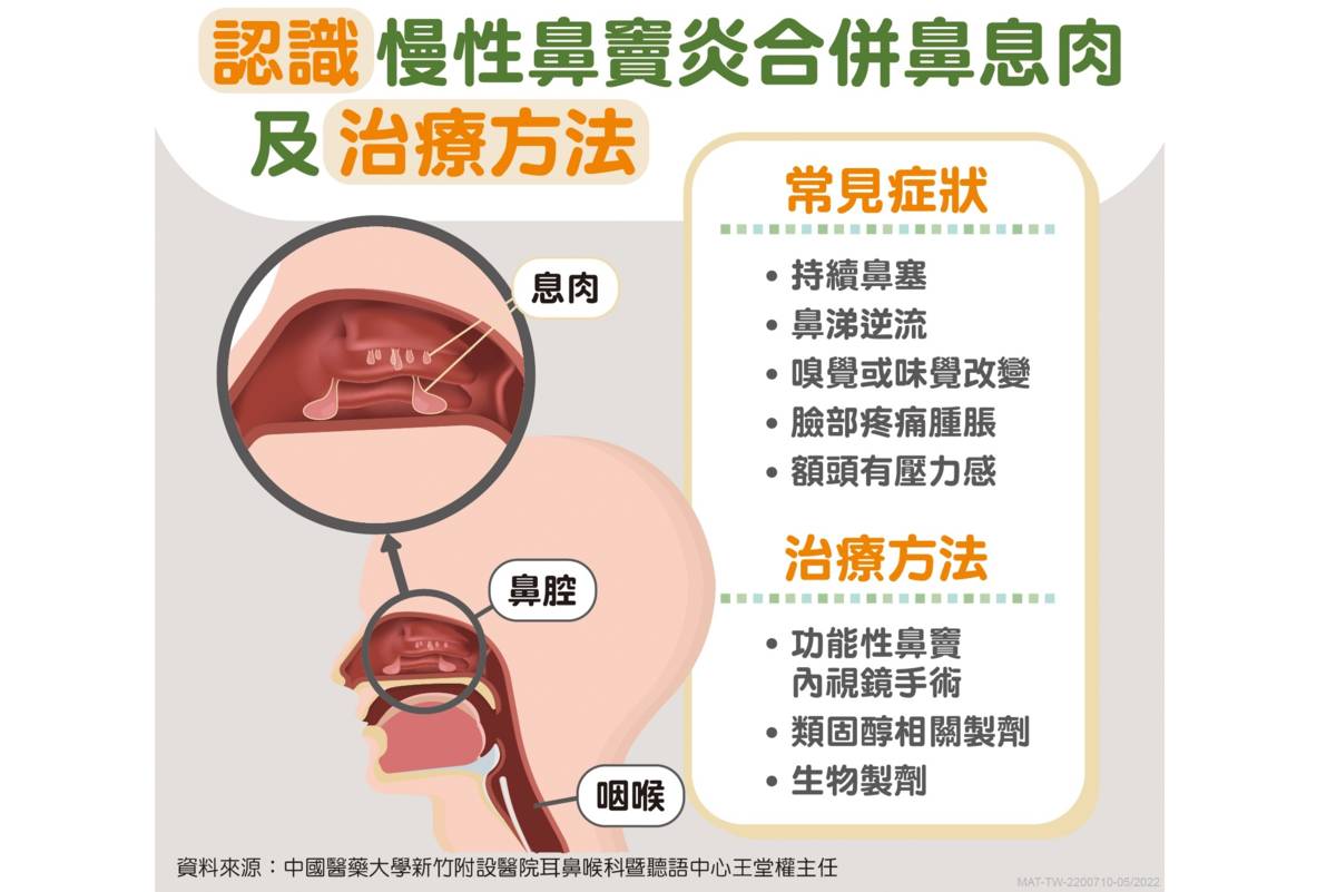 慢性鼻竇炎是一個嚴重影響生活品質的疾病