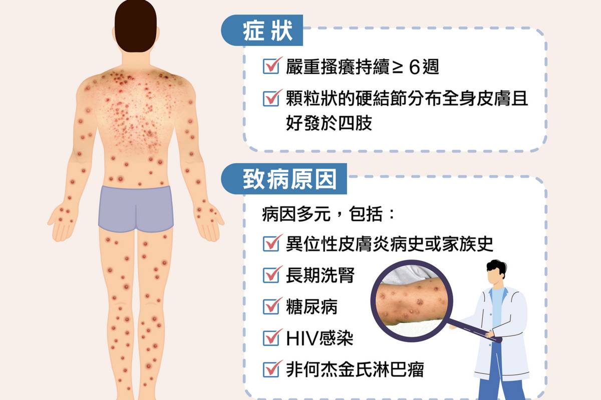 結節性癢疹傳統治療瓶頸多又癢 最新精準治療有解方
