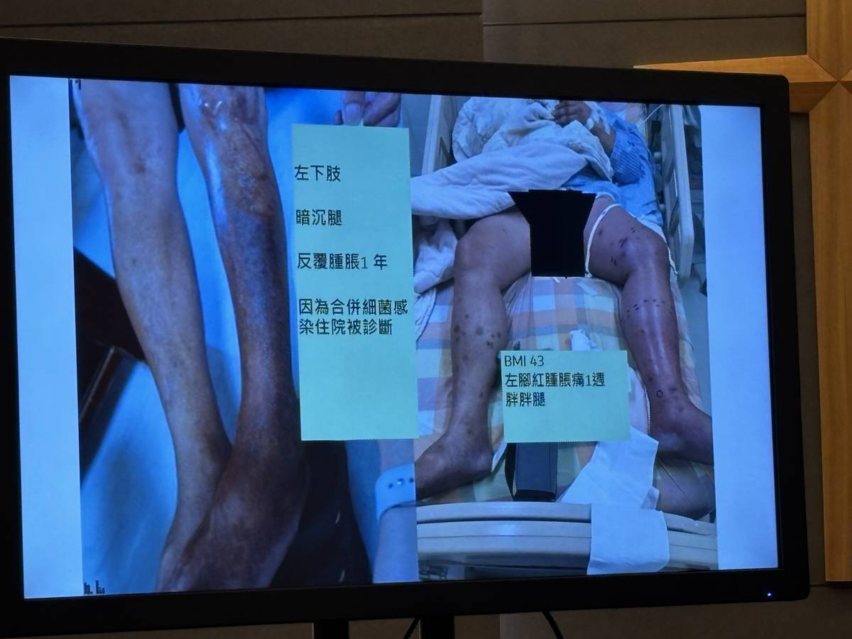 個案說明