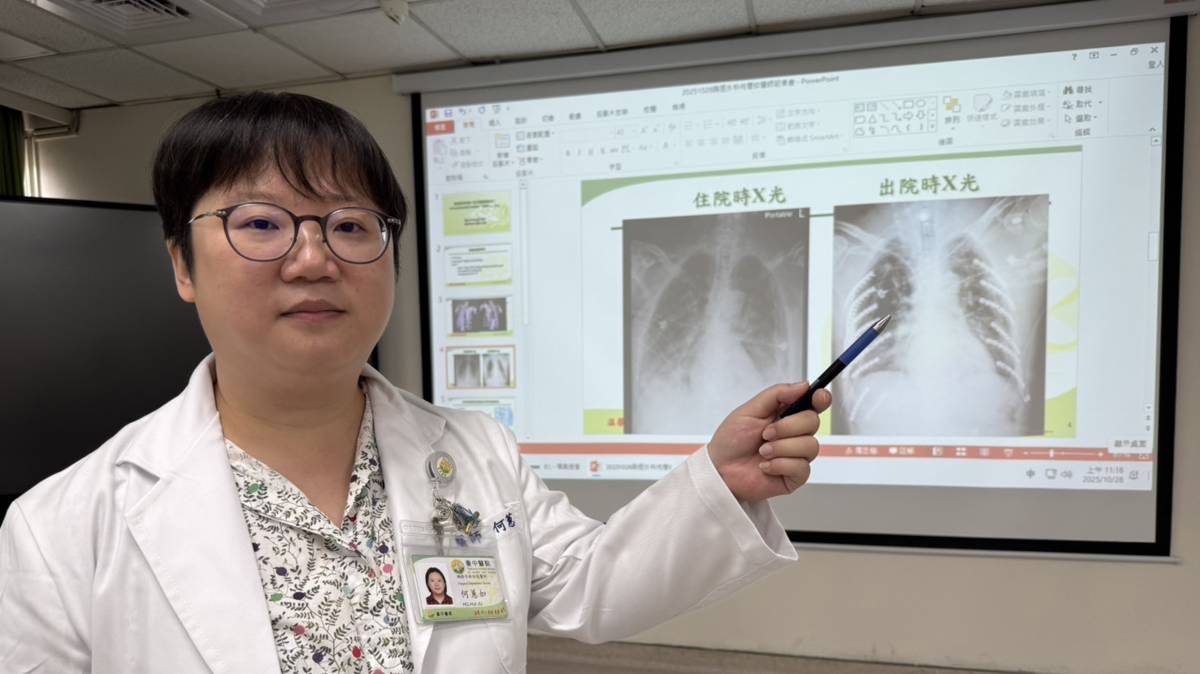 衛生福利部臺中醫院胸腔外科何蕙如醫師